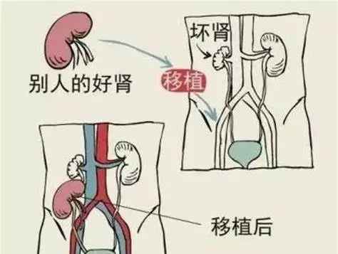 c53a1892e4fe54c8b49e47e92df887bc-sz_24432.jpg