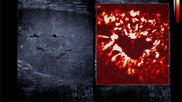 ֲ΢ӽ | hjc888ƽǹڿƼΪơ·(ͼ9)